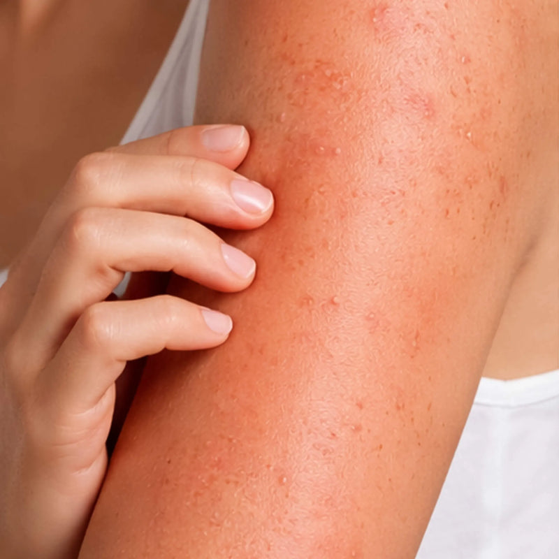 Skin before using blu