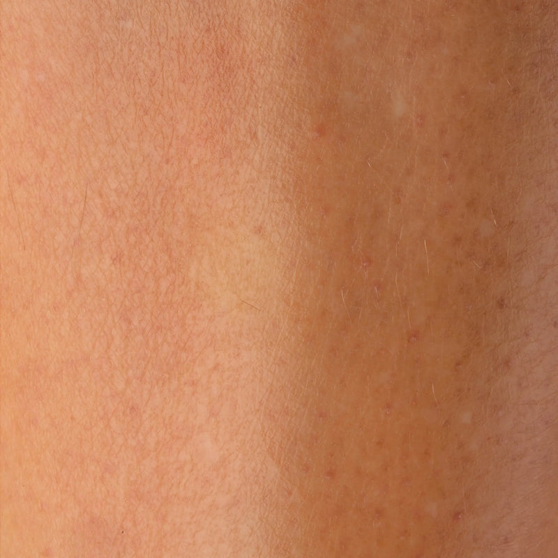 SKIN · 90 DAYS
