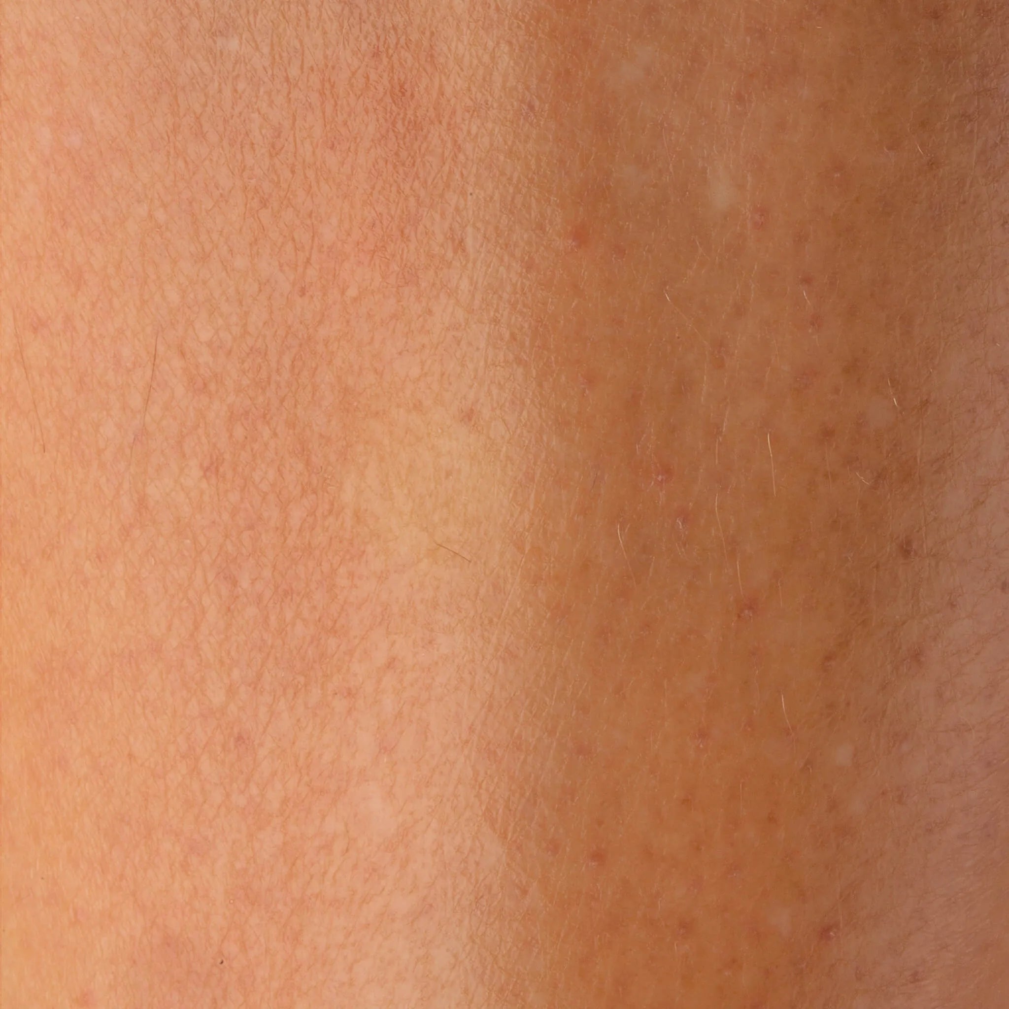 Skin after using blu