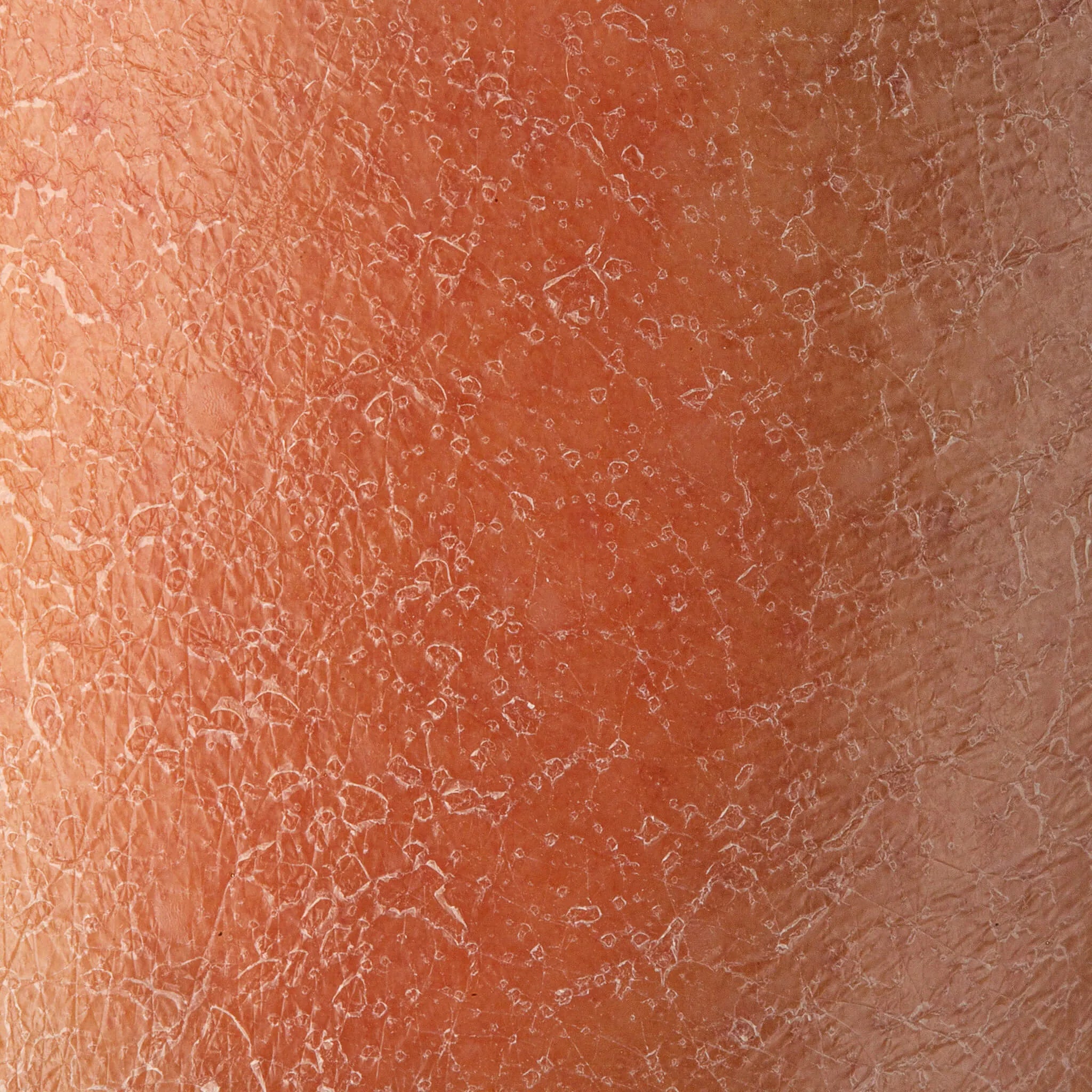 Skin before using blu